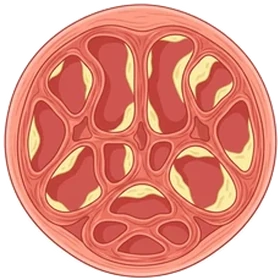 Rigid tissue stage